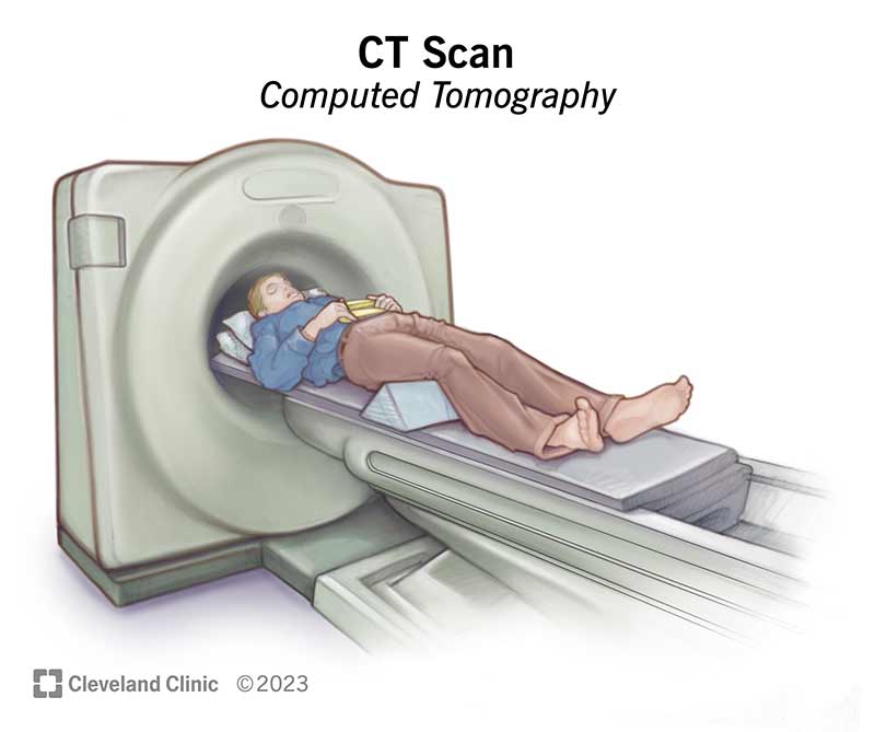 4808-ct-computed-tomography-scan.jpg