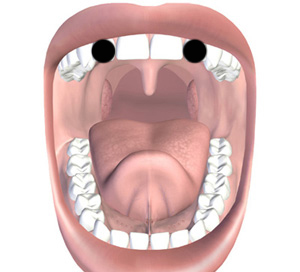 dd6228324b4f00508370ea8252f57a87_-open-mouth-teeth-4-open-mouth-teeth-clipart_300-300.jpg