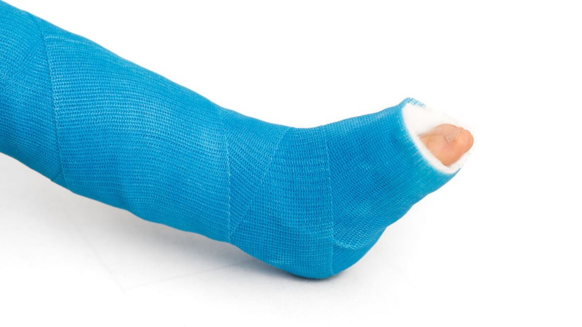 How-Long-Will-My-Broken-Foot-be-Casted-1200x675.jpg